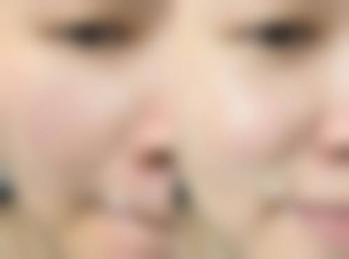 三、烟台谦禾整形医院诊疗项目有哪些?