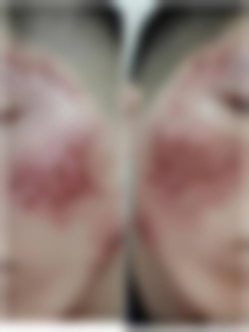 五、呼和浩特华医整形美容医生介绍