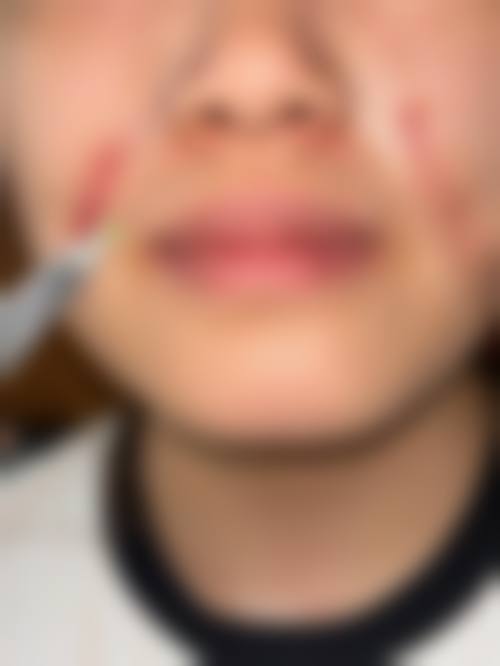 八、汕头大学医学校前列附属医院整形美容外科真实的患者评价