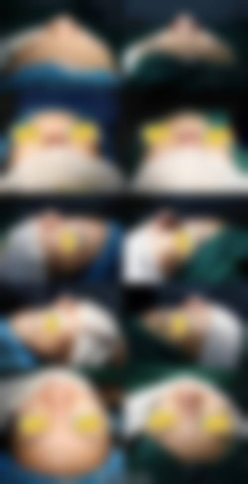 四、枣庄市薛城区人民医院整形科特色项目