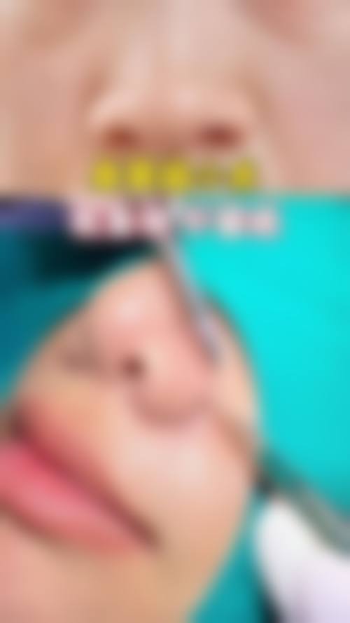 五、保定珍润医疗美容诊所价格表