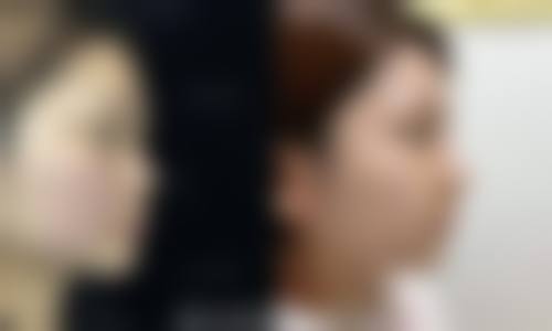 四、汕头大学医学校前列附属医院整形美容外科特色项目