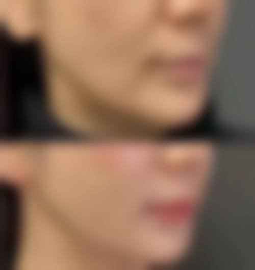 四、保定姮美整形美容医院特色项目