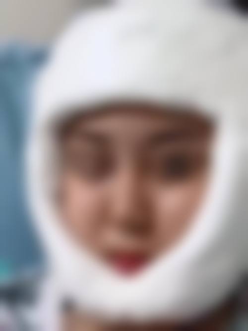 三、枣庄市薛城区人民医院整形科诊疗项目有哪些?