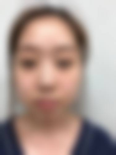 八、池州灵创医美医疗美容医院预约方式