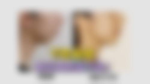 六、呼和浩特华医整形美容价格表