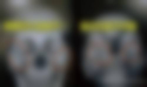 六、枣庄市薛城区人民医院整形科价格表