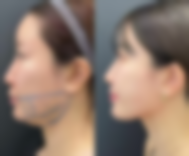 二、天津星范医疗美容门诊部怎么样？