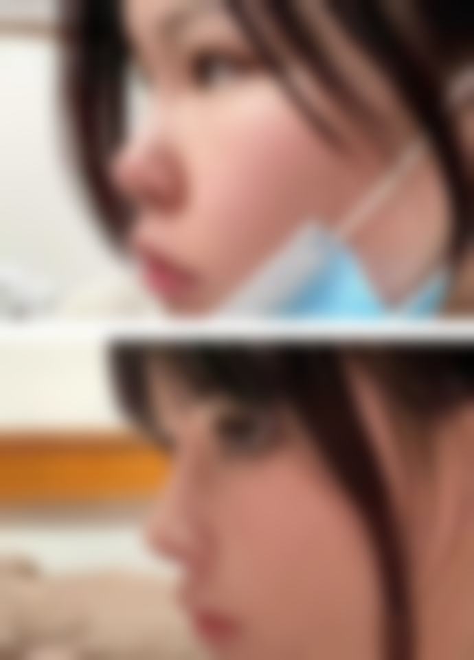 {瘦脸针能吃消炎药吗？打完后不同类型消炎药的使用建议与注意事项揭秘 