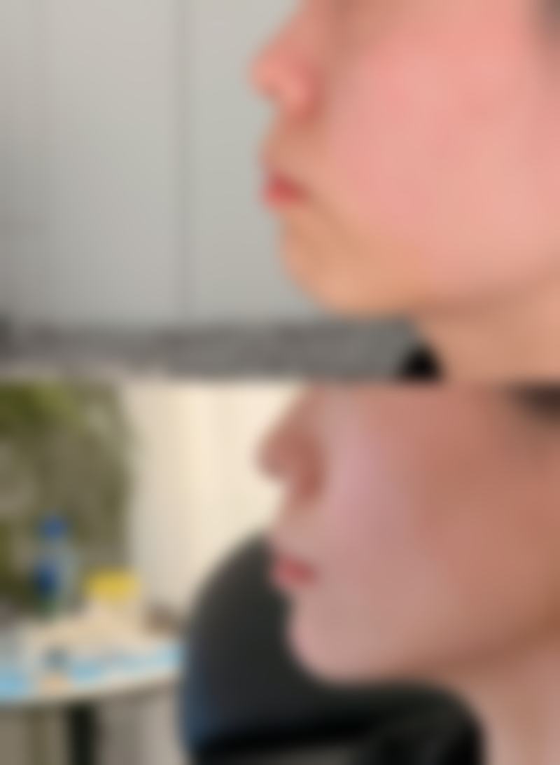 二、治疗方案选择