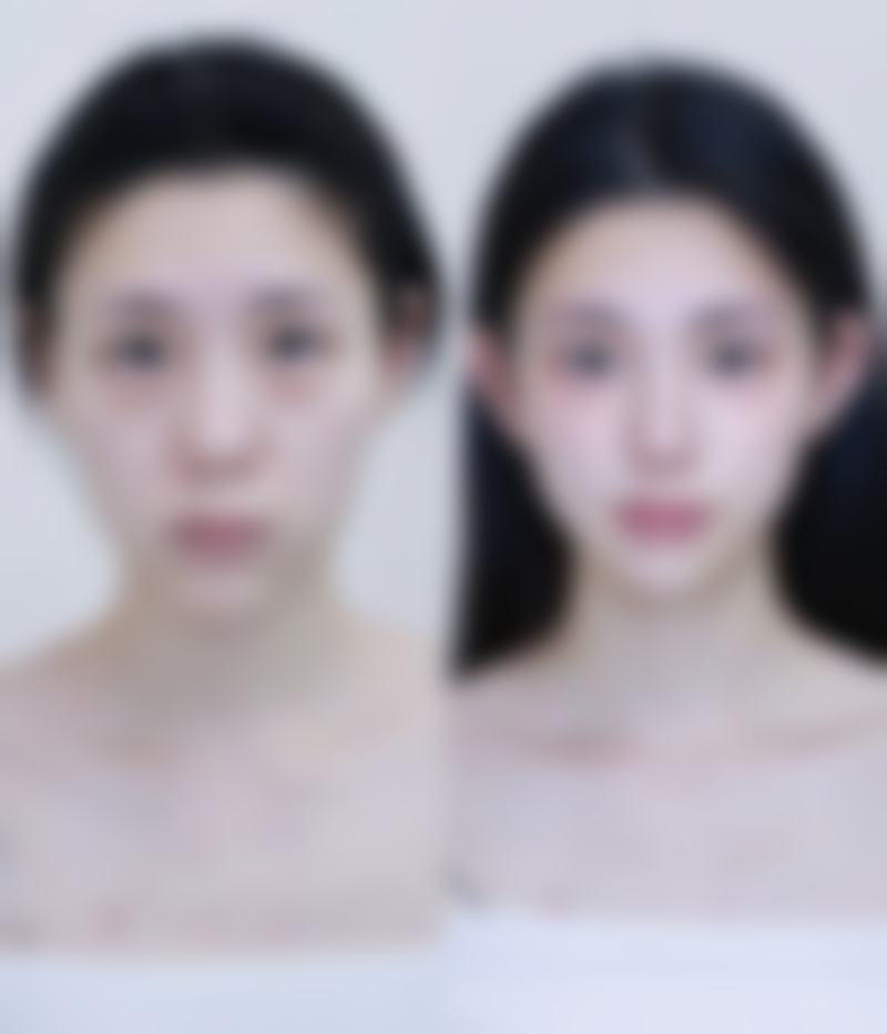 三、保定姮美整形美容医院诊疗项目有哪些？