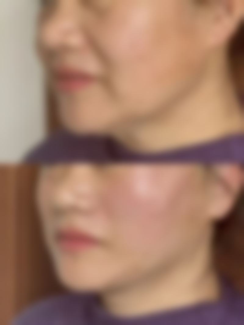 四、象山奈西整形医院特色项目