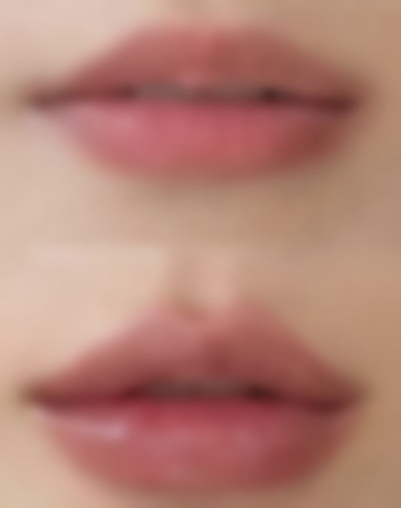 一、了解瘦脸针与消炎药的基本情况