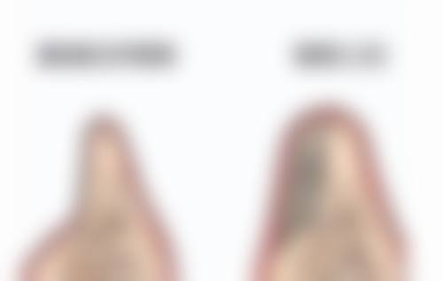 头发种植效果到底好不好？高成活率、自然持久效果为你揭晓答案！ 