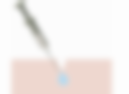 {烫伤老疤痕怎么才能去除？了解这些主流治疗与注意事项或可接近彻底消除