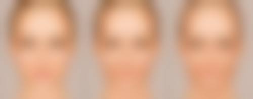 二、生长发育对小时候割双眼皮成效的影响