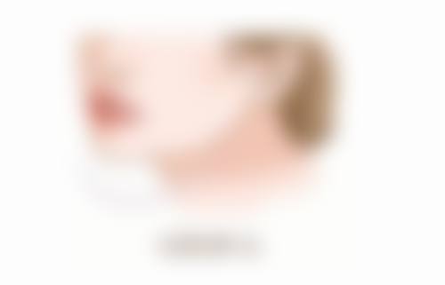 {双眼皮没做好多长时间可以二次调整过来？综合因素评估，3 - 6个月或更久是关键期 