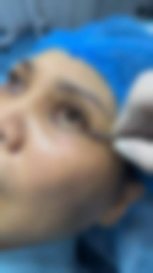 四、郑州蕴美医疗美容医院特色项目