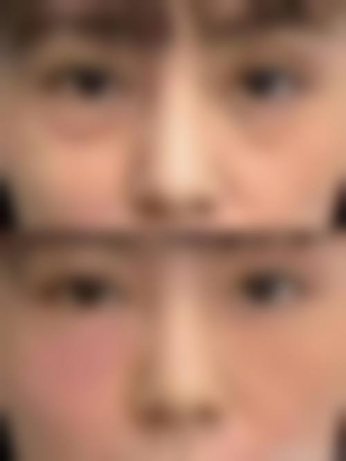 八、郑州蕴美医疗美容医院真实的患者评价