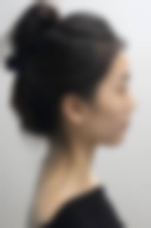 九、广州欣颜医疗美容门诊部真实的患者评价