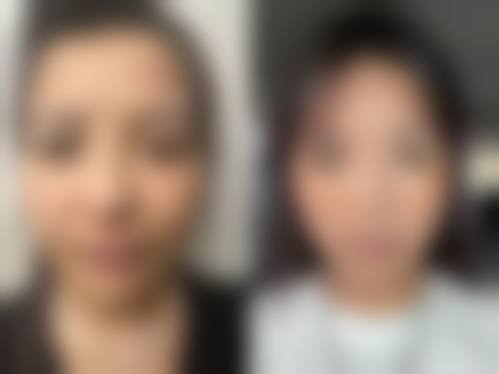 四、咸阳渭城唯星颜医疗美容诊所特色项目