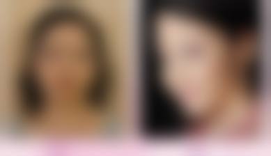 三、杭州宏美时代医疗美容门诊部诊疗项目有哪些？