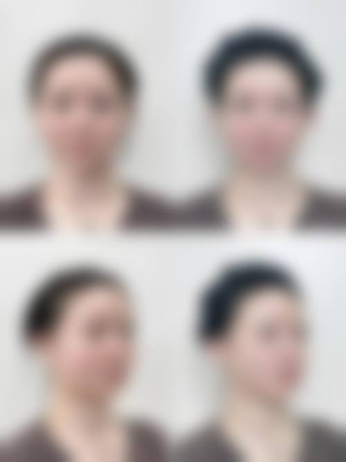 八、镜湖区华美医疗美容诊所真实的患者评价