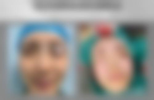 二、佛山市顺德区慢性病防治中 心怎么样？