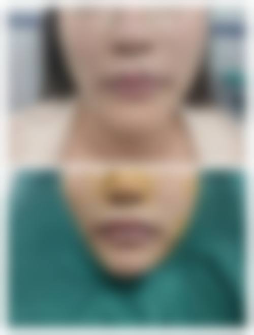 八、武汉贝蓓国内外医疗整形美容医院真实的患者评价