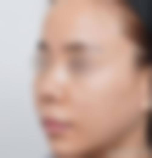 六、玛莎国内外医学美容医院价格表