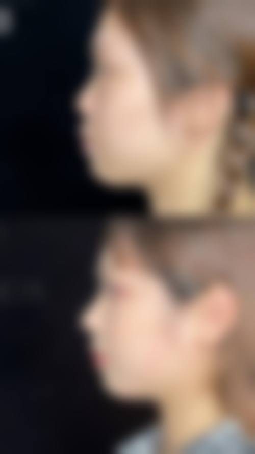 八、广西 南宁悦容医疗美容诊所(熙朵植发)预约方式