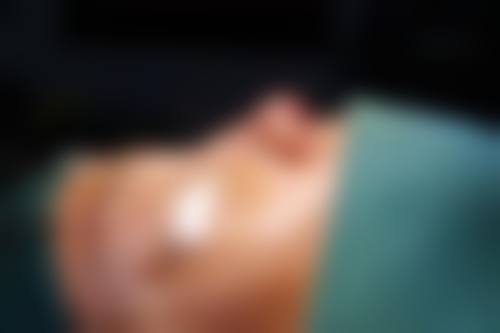 四、镜湖区华美医疗美容诊所特色项目