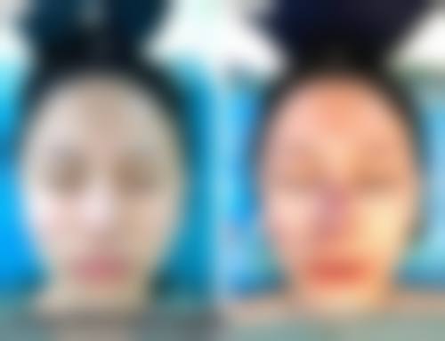 五、杭州宏美时代医疗美容门诊部价格表