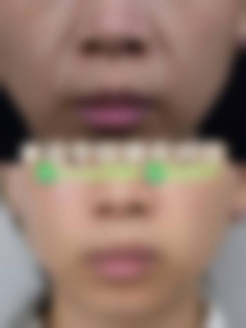 五、镜湖区华美医疗美容诊所价格表