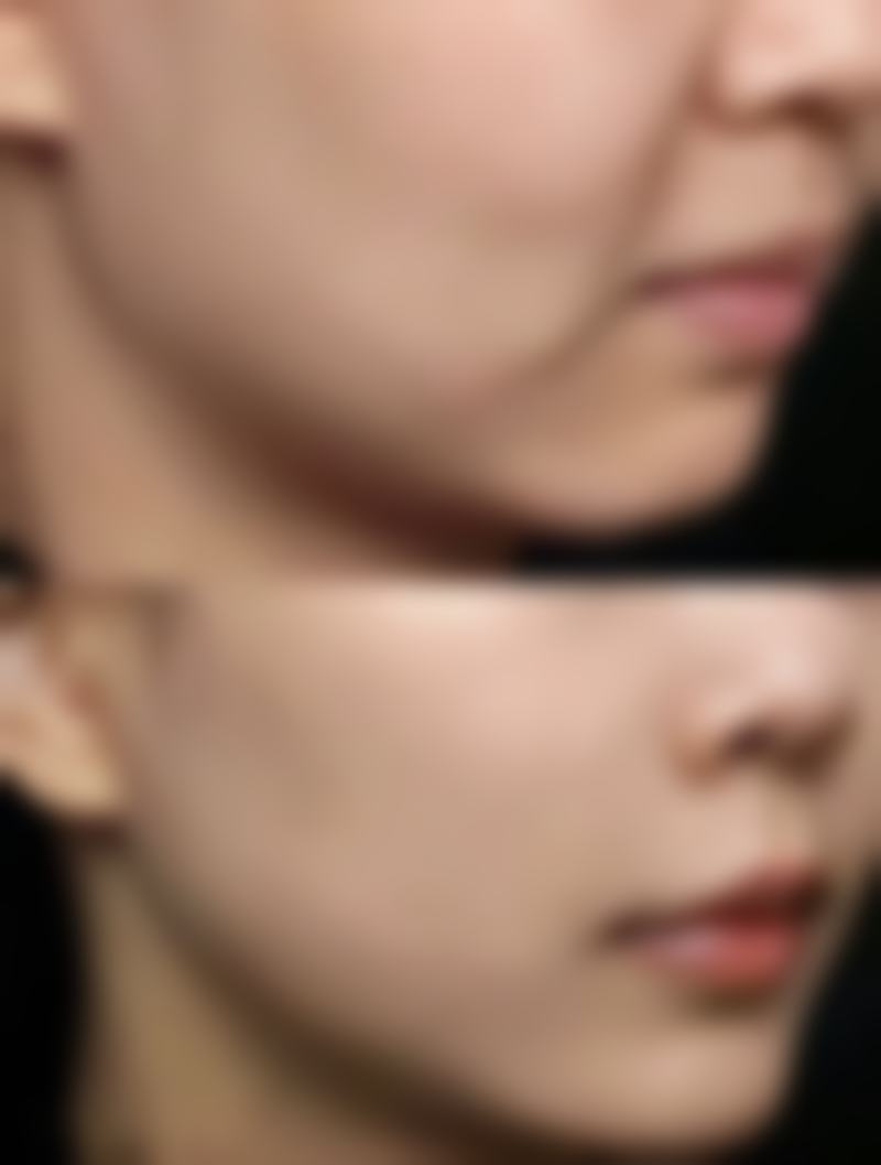 四、四川晶肤医疗整形美容医院特色项目