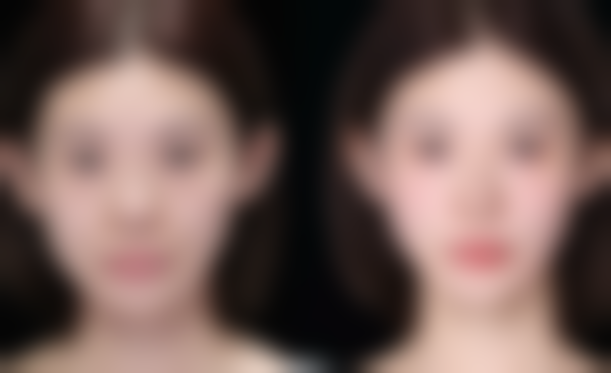 四、新余韩臻轻医疗美容诊所特色项目