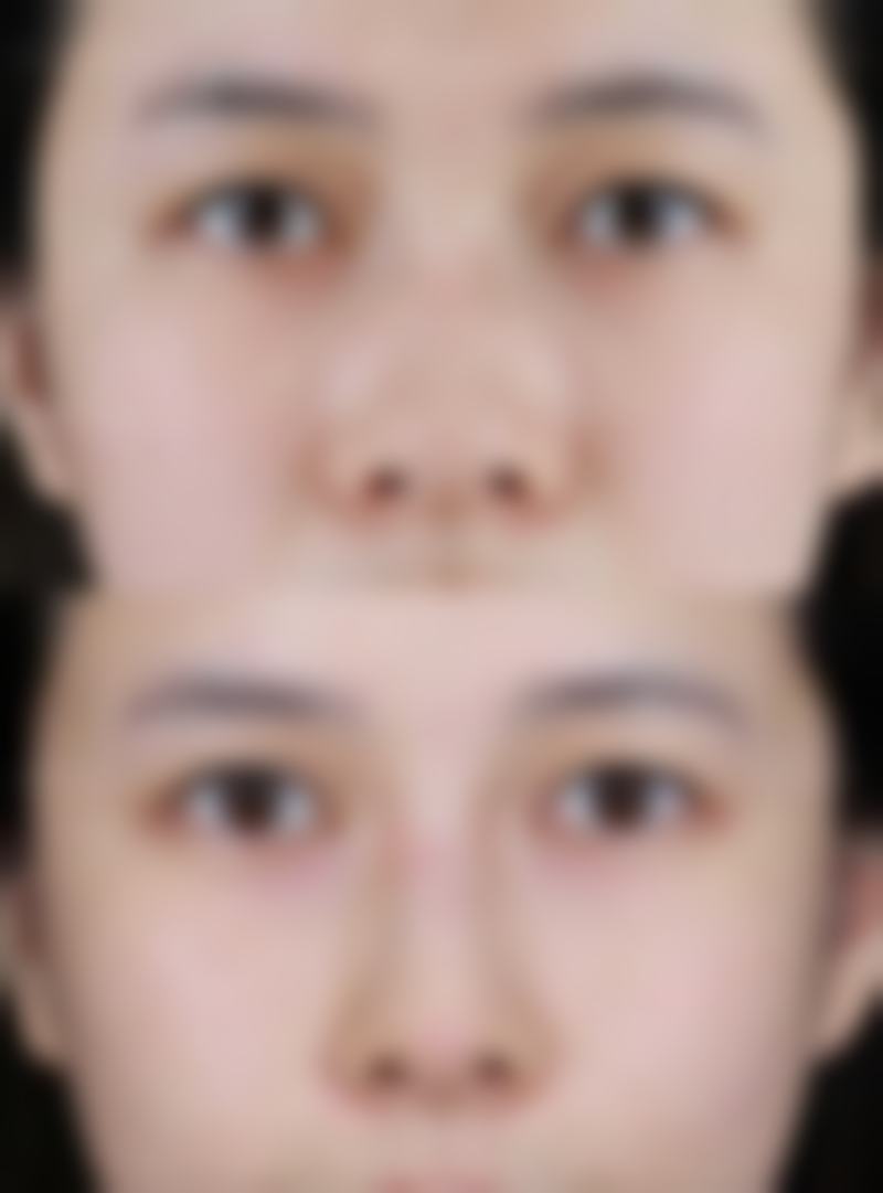 八、沈阳米兰辰杉整形医院真实的患者评价