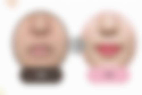 三、具体治疗方案