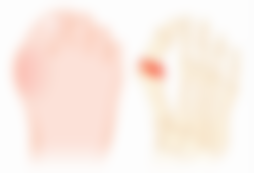 六、异常肿胀的排查