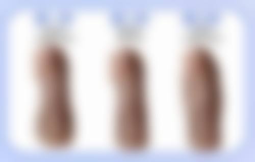 疤痕痘印怎么消除最快？轻医美与日常护理结合，多方案助你高效修复！ 