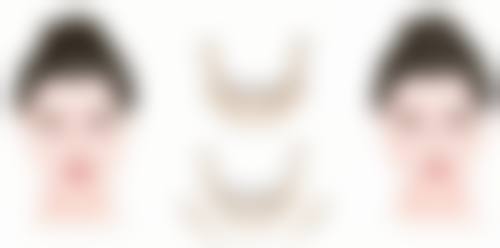 二、轻医美方案消除疤痕痘印