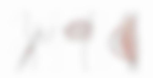 一、了解黑眼圈和眼袋的成因