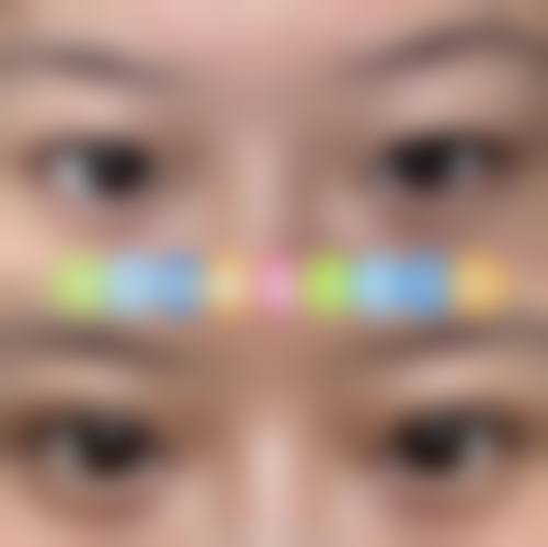 八、沈阳辰熙医疗美容门诊部真实的患者评价