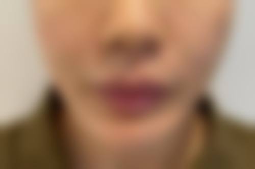 四、杭州西美医疗美容诊所特色项目