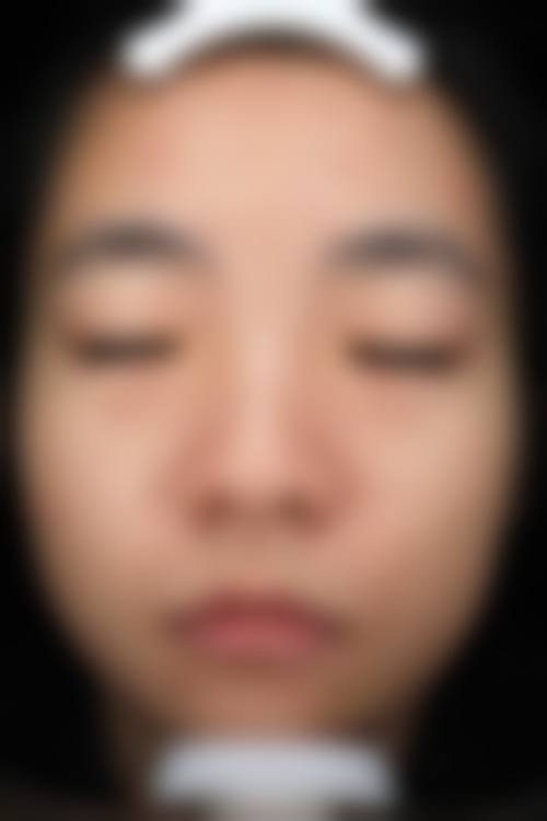 八、楚雄吴氏嘉美医疗美容真实的患者评价