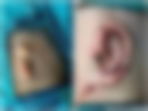 九、辽宁省人民医院整形美容外科真实的患者评价