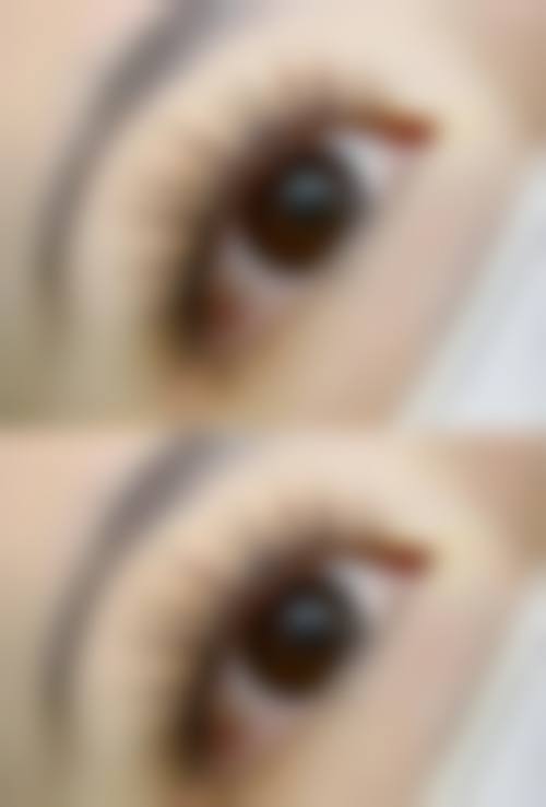 八、浙江衢州青澄整形真实的患者评价