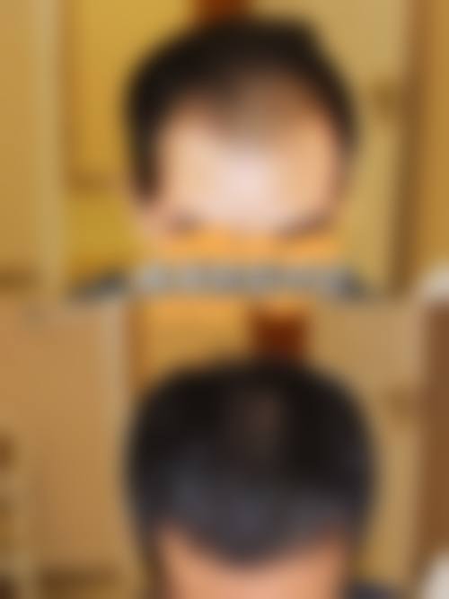 三、武汉武总华科植发专科医院诊疗项目有哪些?