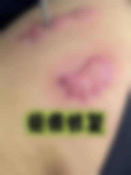 二、浙江衢州青澄整形怎么样？