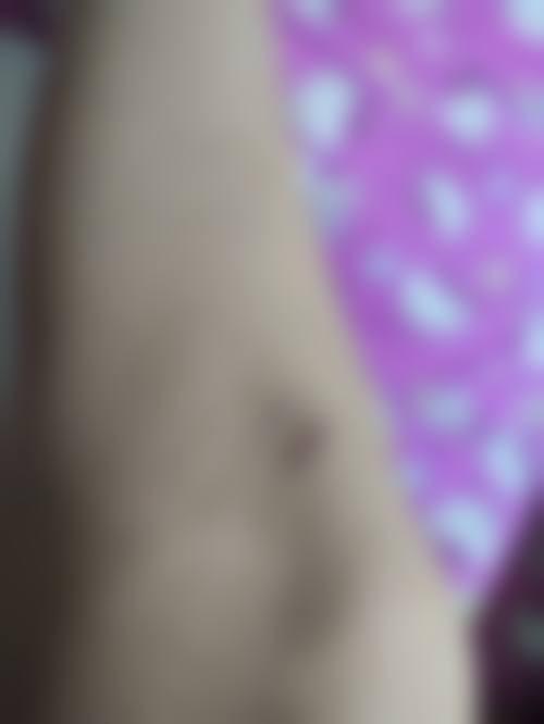 四、浙江衢州青澄整形特色项目